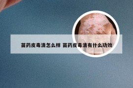 苗药皮毒清怎么样 苗药皮毒清有什么功效
