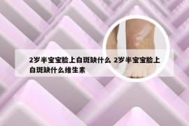 2岁半宝宝脸上白斑缺什么 2岁半宝宝脸上白斑缺什么维生素