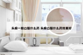 头癣一般口服什么药 头癣口服什么药效果好