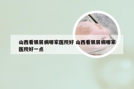 山西看银屑病哪家医院好 山西看银屑病哪家医院好一点