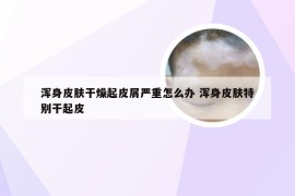 浑身皮肤干燥起皮屑严重怎么办 浑身皮肤特别干起皮