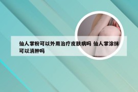 仙人掌粉可以外用治疗皮肤病吗 仙人掌涂抹可以消肿吗