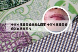 十岁小孩膝盖长癣怎么回事 十岁小孩膝盖长癣怎么回事图片