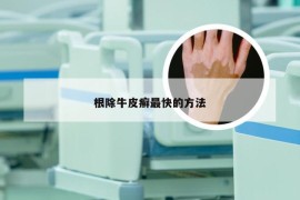 根除牛皮癣最快的方法