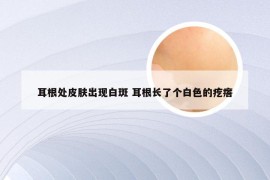 耳根处皮肤出现白斑 耳根长了个白色的疙瘩