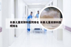 长春儿童皮肤科医院排名 长春儿童皮肤科医院排名