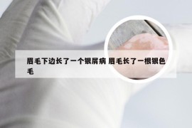 眉毛下边长了一个银屑病 眉毛长了一根银色毛