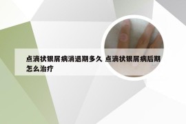 点滴状银屑病消退期多久 点滴状银屑病后期怎么治疗