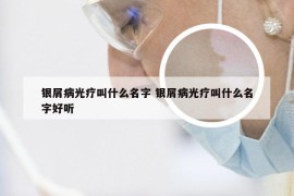 银屑病光疗叫什么名字 银屑病光疗叫什么名字好听