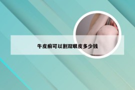 牛皮癣可以割双眼皮多少钱