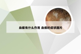 血廨有什么作用 血癣的症状图片