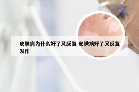 皮肤病为什么好了又反复 皮肤病好了又反复发作