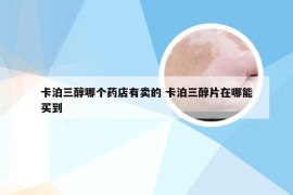 卡泊三醇哪个药店有卖的 卡泊三醇片在哪能买到