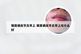 银屑病关节炎早上 银屑病关节炎早上吃什么好