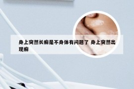 身上突然长癣是不身体有问题了 身上突然出现癣