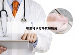 哪里可以打牛皮癣疫苗