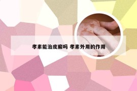 孝素能治皮廨吗 孝素外用的作用