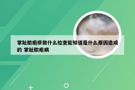 掌趾脓疱疹做什么检查能知道是什么原因造成的 掌趾脓疱病
