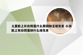 儿童脸上长白斑是什么原因缺乏维生素 小孩脸上有白斑是缺什么维生素