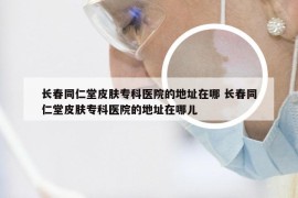 长春同仁堂皮肤专科医院的地址在哪 长春同仁堂皮肤专科医院的地址在哪儿