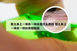 婴儿身上一块白一块白是什么原因 婴儿身上一块白一块白有粗糙感