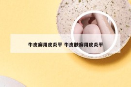 牛皮癣用皮炎平 牛皮肤癣用皮炎平