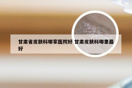 甘肃省皮肤科哪家医院好 甘肃皮肤科哪里最好