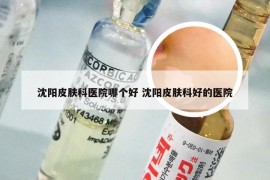 沈阳皮肤科医院哪个好 沈阳皮肤科好的医院