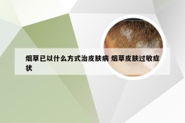 烟草已以什么方式治皮肤病 烟草皮肤过敏症状