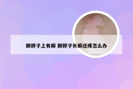 脚脖子上有癣 脚脖子长癣还痒怎么办