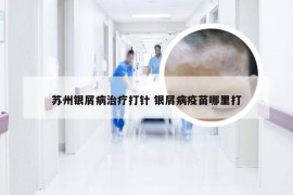 苏州银屑病治疗打针 银屑病疫苗哪里打