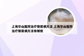上海华山医院治疗银屑病方法 上海华山医院治疗银屑病方法有哪些