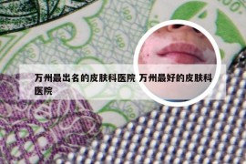 万州最出名的皮肤科医院 万州最好的皮肤科医院