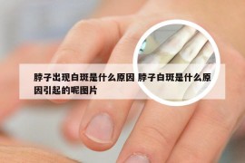 脖子出现白斑是什么原因 脖子白斑是什么原因引起的呢图片