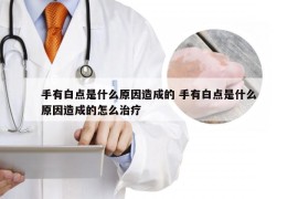 手有白点是什么原因造成的 手有白点是什么原因造成的怎么治疗