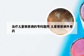 治疗儿童银屑病的专科医院 儿童银屑病外用药