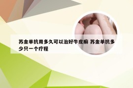 苏金单抗用多久可以治好牛皮癣 苏金单抗多少只一个疗程