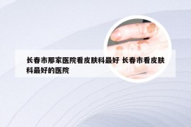 长春市那家医院看皮肤科最好 长春市看皮肤科最好的医院