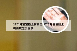 17个月宝宝脸上有白斑 17个月宝宝脸上有白斑怎么回事