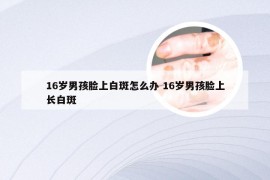 16岁男孩脸上白斑怎么办 16岁男孩脸上长白斑