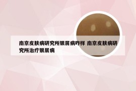 南京皮肤病研究所银屑病咋样 南京皮肤病研究所治疗银屑病