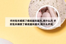 手肘处长癣抓了癣皮越长越大,用什么药 手肘处长癣抓了癣皮越长越大,用什么药膏