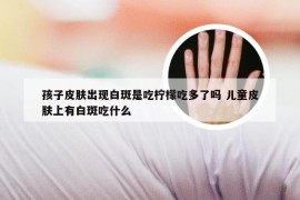 孩子皮肤出现白斑是吃柠檬吃多了吗 儿童皮肤上有白斑吃什么