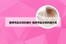 胳膊弯起白斑的图片 胳膊弯起白斑的图片男