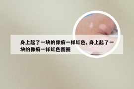 身上起了一块的像癣一样红色, 身上起了一块的像癣一样红色圆圈