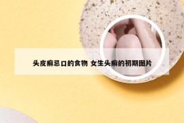 头皮癣忌口的食物 女生头癣的初期图片