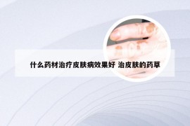 什么药材治疗皮肤病效果好 治皮肤的药草