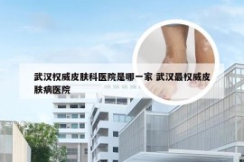 武汉权威皮肤科医院是哪一家 武汉最权威皮肤病医院
