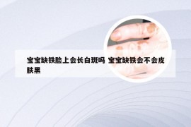 宝宝缺铁脸上会长白斑吗 宝宝缺铁会不会皮肤黑