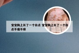 宝宝胸上长了一个白点 宝宝胸上长了一个白点不痛不痒